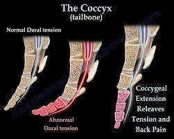 Check spelling or type a new query. Coccyx Tailbone Pain Coccydynia Everything You Need To Know Dr Nabil Ebraheim Youtube