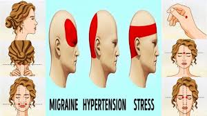 6 Pressure Points For Soothing Headache Tension Easily Pressure Headache Pressure Points For Headaches Headache Types