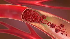 Hot water from a shower or bath can help improve your body's circulation. 10 Easy Ways To Improve Circulation And Blood Flow Chicago Vein