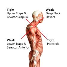 The muscles that form rotator cuff are the axillary nerve related to the surgical neck of humerus may get injured. Everything You Need To Know About Neck And Shoulder Pain Root Causes And Solutions Levitise