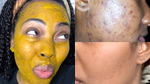 Include 1 teaspoon of nectar and 1 teaspoon of sunflower oil with the white of one egg in a little bowl and blend them well till. 12 Homemade Face Mask Tutorials And Diys For Every Skin Type In 2021