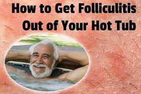 Maybe you would like to learn more about one of these? How To Get Folliculitis Out Of Your Hot Tub