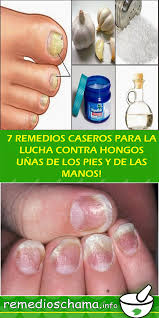 Maybe you would like to learn more about one of these? Hongos Unas Manos Fotos Elegantes Unas Acrilicas