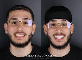 Una nueva sonrisa boricua! 🫶🇵🇷🤩