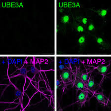 According to the food and drug administration (fda), most people in. Protein Linked To Autism Location Location Location Matters