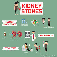 Anyone Can Get A Kidney Stone But Some People Are More Likely Than Others To Have Them Men Get Kidney Stones More Often Tha Kidney Stones Backache Shock Wave