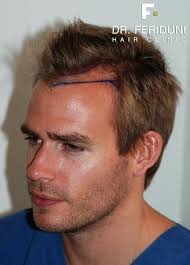 top frisuren frisuren trend frisuren dunnes haar neue frisuren herren frisuren geheimrats frisur wenig haare frisur geheimratsecken frisuren rundes gesicht