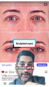 Winged Blepharoplasty: Achieve Sculpted Eyes Now