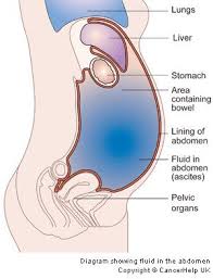 Pin On Nursing Skills