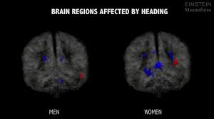 Most common artifacts in ct are. Heading A Soccer Ball Harms Women More Than Men Study Finds