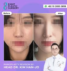 ❤️‍🔥Before & After