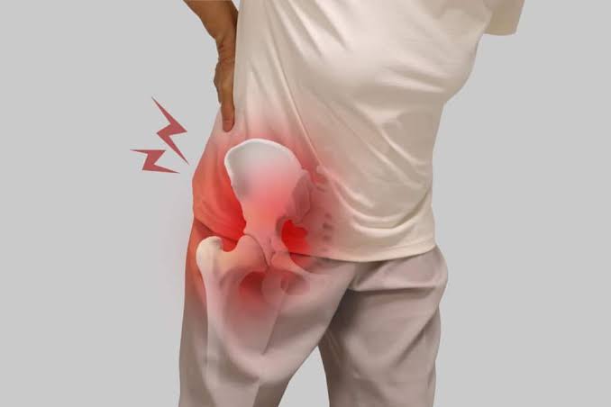 Common Causes of Hip Pain and How to Address Them