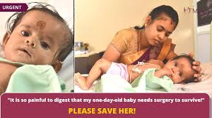 Donate at http://bit.ly/help-saisha-5 Saisha was diagnosed with Esophageal  Atresia as soon as she was born. It is a birth defect that caused her food  pipe to not develop properly. She is unable