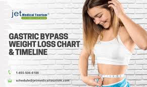 Check spelling or type a new query. Gastric Bypass Weight Loss Chart Timeline 2020 Jet Medical Tourism