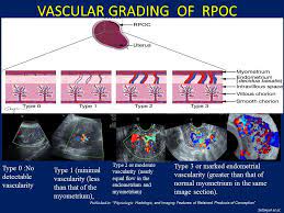 Ultrasound in the detection of rpoc, but 15 women. Epos C 0467