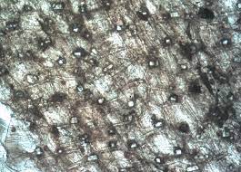 Some of these organelles, and other structures, are. Druse Botany Wikipedia