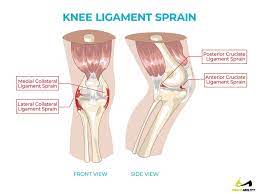 Jumper's knee weakens your tendon, and, if untreated, can lead to tears in your tendon. Pain Behind Knee Why It Hurts In Back Of Or Under Your Kneecap
