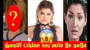 جنون مودل روز هذه المرّة دفعها إلى المخاطرة والقيام بـ عملية تجميل في عينيها، وتحديدًا عند منطقة جفونها، خصوصًا أنّها كانت تريد أن توسّع Ø²ÙŠÙ† ÙƒØ±Ø²ÙˆÙ† Ù‚Ø¨Ù„ Ø¹Ù…Ù„ÙŠØ§Øª Ø§Ù„ØªØ¬Ù…ÙŠÙ„ Ù…ÙˆØ³ÙŠÙ‚Ù‰ Ù…Ø¬Ø§Ù†ÙŠØ© Mp3