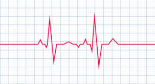 Check spelling or type a new query. Ecg Basics