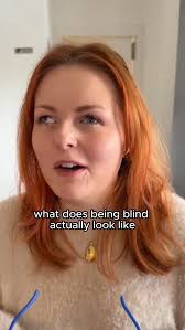 Although Brennan's response is much more entertaining, the truth is a  genetic condition called Leber's Congenital Amaurosis (LCA). LCA is a rare  inherited eye disorder affecting approximately 1 to 2 per 100,000