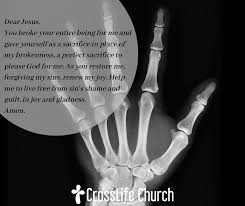 Bones protect the various organs of the body, produce red and white blood cells, store minerals. 2 27 20 Broken Bones Crosslife Church