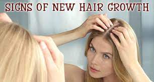 Certain nutrients help your hair grow and stave off breakage from damage. What Are The Signs Of New Hair Growth Lewigs