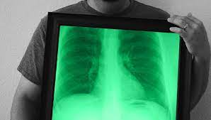 More Messing Around With Photoshop And My X Ray Illustration Art Photoshop X Ray Images