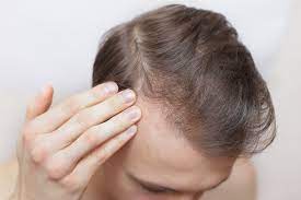 Itchy Scalp Causes And Connections To Hair Loss Trichology