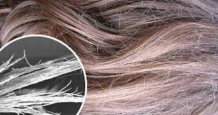 Si Vos Cheveux Sont Brules Secs Rugueux Sans Vie Et Abimes Voila Des Masques Capillaires Pour Reparer Vos Cheveux Burnt Hair Hair Repair Hair Dryer Brands