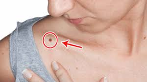 Bone cancer often hurts from the beginning. 20 Early Warning Signs That Cancer Is Growing In Your Body Wise Diaries