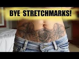 Stretch marks are one of the most complex procedures, as they are many factors that all need to be taken in consideration , and take years to master. Tattoo Cover Up Design Idea Against Stretch Marks Belly Tummy Stomach Tattoo Youtube