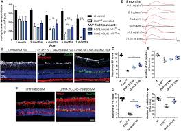 Shower and bathroom curtains help you to maintain some privacy whilst unwinding after a long day. Prevention Of Photoreceptor Cell Loss In A Cln6nclf Mouse Model Of Batten Disease Requires Cln6 Gene Transfer To Bipolar Cells Molecular Therapy