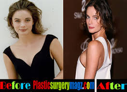 The number of people getting cosmetic procedures has risen steadily over the past five years and there are several reasons why. Gabrielle Anwar Plastic Surgery Before And After Plastic Surgery Magazine