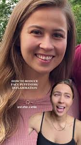 I hope this helps! OH and being mindful of my water intake has also made a  huge difference👌🏼💦✨ #faceinflammation #facepuffiness #puffyfacesolution  #puffyface #puffyfacehack #facialmassage ...