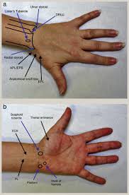 Image result for Scaphoid Shift Test