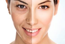 Cara Menghilangkan Kerutan di Wajah