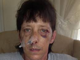 3 Ohio teens plead in 'bored' beating case