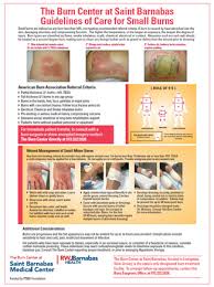 First Aid And Emergency Care The Burn Center New Jersey