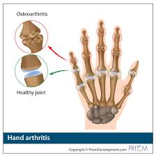 Image result for Hand Anatomy