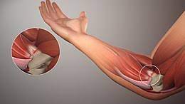 These muscles are important to keep. Golfer S Elbow Wikipedia
