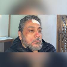 Egyptian artist seriously injured during filming