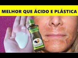 HUGO ALEXANDER AUGUSTE (alexanderauguste)