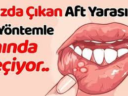 Aft Yarasi Neden Cikar Kac Gunde Nasil Gecer Bitkilog Memes Diet Karma