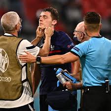 Uefa says it has accepted the france team's explanation that benjamin pavard did not sustain a concussion in the european championship. R2jtep Wwzt Nm