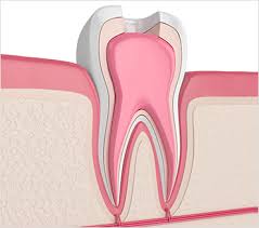 Check spelling or type a new query. Root Canal Treatment Gentle Dental Of New England