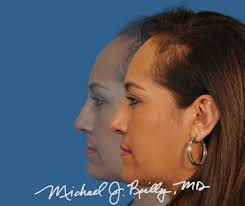 Tough to be saying goodbye today to my fantastic resident, Jason Crossley,  who has been my right-hand man for the last four months. Jason is an  inspiring young surgeon with a tremendous