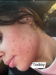 World Carnivore Tribe