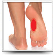 Plante  plɑ̃t  n. Le Mal De Pied Comment Soulager Et Traiter Ceo Medic Ca