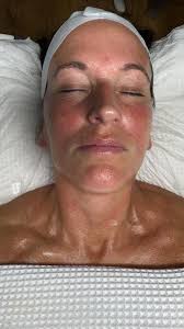 Your Ritual for Radiant Skin in 2026 starts with a SKIN ANALYSIS  formulating the science behind your skin and where Charlotte  @cr_aesthetics2020 devises the treatment plan. , Niki @lemontreebakeryuk ...