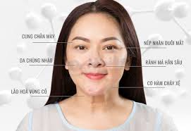 Căng chỉ nano kim cương là gì? Quy trình thực hiện